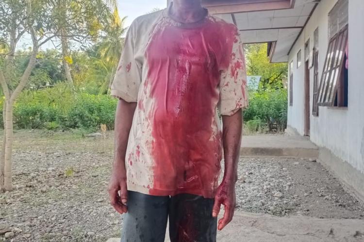 [ID] Korban Dicekik Sampai Berlumuran Darah, Penganiayaan Berat Terjadi di Tainsala, TTU